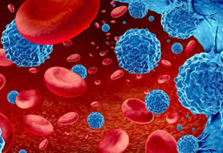 CAR-T细胞疗法 以改造细胞对抗癌细胞